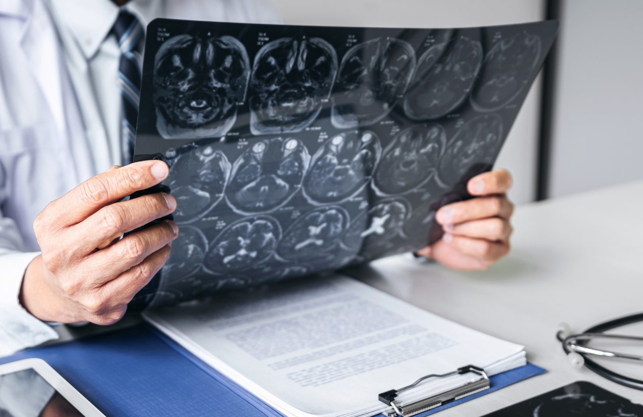 Unique Medical Experts: Clinical Neuropsychologists and Cognitive Assessments